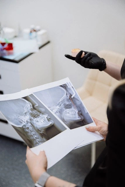 Dental X-ray review at Smile Dentistry Shanghai