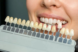 Shade Assessment & Gum Protection