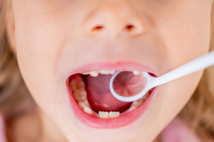 Child-Friendly Oral Check